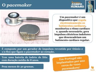 O pacemaker
Um pacemaker é um
dispositivo que regula
electronicamente os
batimentos cardíacos,
monitoriza o ritmo cardíaco
e, quando necessário, gera
impulsos eléctricos indolores
que desencadeiam um
batimento cardíaco regular.
É composto por um gerador de impulsos revestido por titânio e
1/2 fios que ligam o pacemaker ao coração.
Tem uma bateria de iodeto de lítio
com duração média de 8 anos.
Pesa menos de 30 gramas.
Em Portugal são
implantados por ano
cerca de 7000
pacemakers!
Em Portugal são
implantados por ano
cerca de 7000
pacemakers!
 