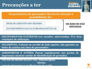 Precauções a ter
Os portadores de pacemaker devem ter atenção à
possibilidade de:
Os portadores de pacemaker devem ter atenção à
possibilidade de:
DESLOCAMENTO DO MESMO
INTERFERÊNCIAS ELETROMAGNÉTICAS
EQUIPAMENTOS ELÉTRICOS (ex: secador, microondas, TV): Sem
restrições de utilização.
TELEMÓVEL: Colocar no ouvido do lado oposto; não guardar no
bolso da camisa em cima do pacemaker.
AEROPORTOS E AVIÕES: Passar rapidamente nas portas de
segurança; mostrar cartão de identificação de portador.
OS RISCOS SÃO
MÍNIMOS
TÉCNICAS MÉDICAS (ex: TAC, radioterapia):
Alertar
antecipadamente os profissionais de saúde.
 