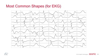 © 2014 MapR Technologies 43
Most Common Shapes (for EKG)
 