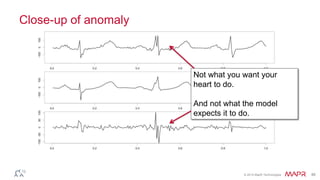© 2014 MapR Technologies 46
Close-up of anomaly
Not what you want your
heart to do.
And not what the model
expects it to do.
 