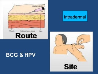 Places For Fip Injection m1701700111hrgenrkhmthrejhotrkoerjhoetkh[otehk.pdf