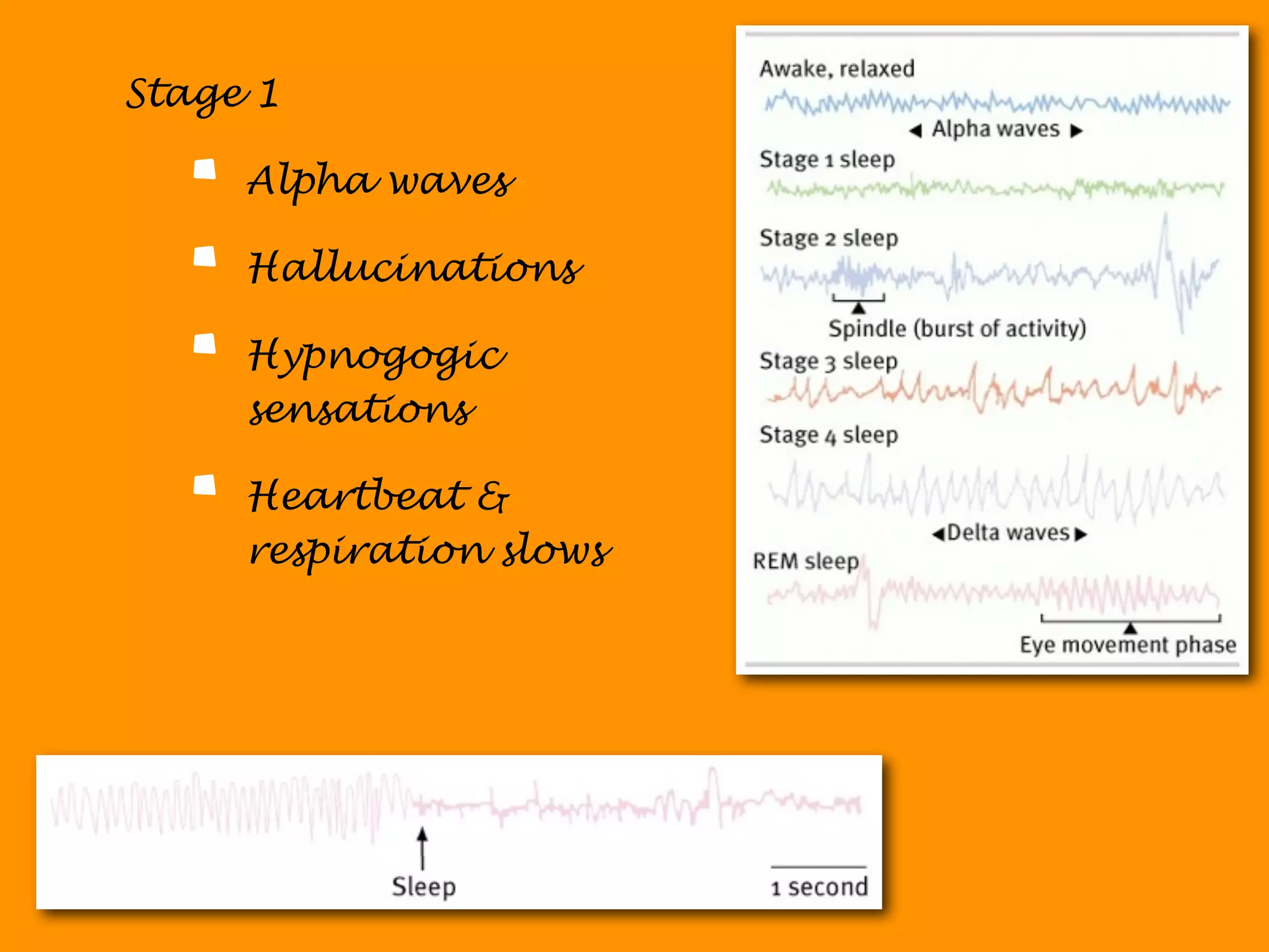 Stage 1

     Alpha waves

     Hallucinations

     Hypnogogic
     sensations

     Heartbeat &
     respiration slows
 
