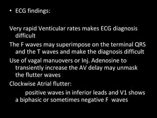 ECG findings: Very rapid Venticular rates makes ECG diagnosis difficult The F waves may superimpose on the terminal QRS and the T waves and make the diagnosis difficult Use of vagal manuovers or Inj. Adenosine to transiently increase the AV delay may unmask the flutter waves  Clockwise Atrial flutter: positive waves in inferior leads and V1 shows a biphasic or sometimes negative F  waves 