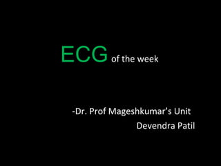 ECG   of the week  ,[object Object],[object Object]