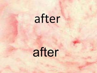 after
after
 