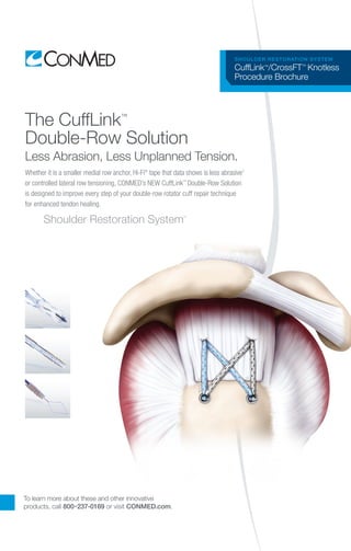 To learn more about these and other innovative
products, call 800-237-0169 or visit CONMED.com.
SHOULDER RESTORATION SYSTEM
CuffLink™
/CrossFT™
Knotless
Procedure Brochure
The CuffLink™
Double-Row Solution
Less Abrasion, Less Unplanned Tension.
Whether it is a smaller medial row anchor, Hi-Fi®
tape that data shows is less abrasive1
or controlled lateral row tensioning, CONMED’s NEW CuffLink™
Double-Row Solution
is designed to improve every step of your double-row rotator cuff repair technique
for enhanced tendon healing.
Shoulder Restoration System™
 