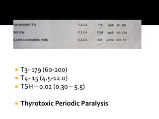 T3- 179 (60-200)T4- 15 (4.5-12.0)TSH – 0.02 (0.30 – 5.5)Thyrotoxic Periodic Paralysis
