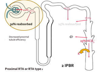 NaCl, waterDistal Tubule Na+ reabsorbed