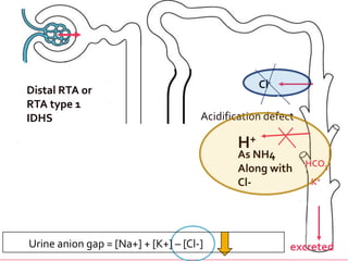 Cl-Distal RTA or RTA type 1Acidification defectH+HCO3-K+1 IDHS excreted