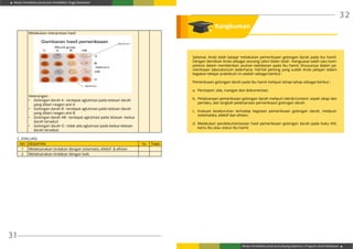 Modul Pendidikan Jarak Jauh Pendidikan Tinggi Kesehatan
Modul Pendidikan Jarak Jauh Jenjang Diploma 3 Program Studi Kebidanan
31
32
Selamat, Anda telah belajar melakukan pemeriksaan golongan darah pada ibu hamil.
Dengan demikian Anda sebagai seorang calon bidan telah menguasai salah satu kom-
petensi dalam memberikan asuhan kebidanan pada ibu hamil, khususnya dalam pe-
meriksaan laboratorium sederhana. Hal-hal penting yang sudah Anda pelajari dalam
kegiatan belajar praktikum ini adalah sebagai berikut :
Pemeriksaan golongan darah pada ibu hamil meliputi tahap-tahap sebagai berikut :
a.	 Persiapan: alat, ruangan dan dokumentasi.
b.	 Pelaksanaan pemeriksaan golongan darah meliputi teknik/content: aspek sikap dan
perilaku, dan langkah pelaksanaan pemeriksaan golongan darah.
c.	Evaluasi keseluruhan terhadap kegiatan pemeriksaan golongan darah, meliputi:
sistematika, efektif dan efisien.
d.	Melakukan pendokumentasian hasil pemeriksaan golongan darah pada buku KIA,
kartu ibu atau status ibu hamil.
Melakukan interpretasi hasil
Keterangan :	
•	 Golongan darah A : terdapat aglutinasi pada tetesan darah
yang diberi reagen anti A
•	 Golongan darah B : terdapat aglutinasi pada tetesan darah
yang diberi reagen anti B
•	 Golongan darah AB : terdapat aglutinasi pada tetesan kedua
darah tersebut
•	 Golongan darah O : tidak ada aglutinasi pada kedua tetesan
darah tersebut.
C. EVALUASI
NO KEGIATAN Ya Tidak
1 Melaksanakan tindakan dengan sistematis, efektif & efisien
2 Melaksanakan tindakan dengan baik
Rangkuman
 