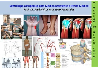 Semiologia Ortopédica para Médico Assistente e Perito Médico
Prof. Dr. José Heitor Machado Fernandes
2ª
V
E
R
S
Ã
O
DO
H
I
P
E
R
T
E
X
T
O
 