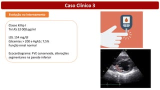 Caso Clínico 3
Evolução no internamento
Classe Killip I
TnI AS 32 000 pg/ml
LDL 154 mg/dl
Glicemias > 200 e HgA1c 7,5%
Função renal normal
Ecocardiograma: FVE conservada, alterações
segmentares na parede inferior
 