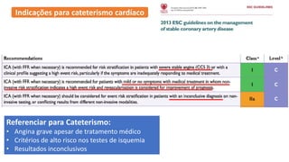 Indicações para cateterismo cardíaco
Referenciar para Cateterismo:
• Angina grave apesar de tratamento médico
• Critérios de alto risco nos testes de isquemia
• Resultados inconclusivos
 