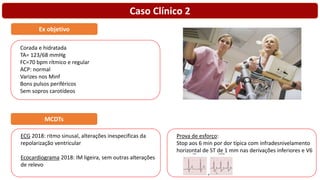 Caso Clínico 2
Corada e hidratada
TA= 123/68 mmHg
FC=70 bpm rítmico e regular
ACP: normal
Varizes nos Minf
Bons pulsos periféricos
Sem sopros carotídeos
Ex objetivo
MCDTs
ECG 2018: ritmo sinusal, alterações inespecificas da
repolarização ventricular
Ecocardiograma 2018: IM ligeira, sem outras alterações
de relevo
Prova de esforço:
Stop aos 6 min por dor típica com infradesnivelamento
horizontal de ST de 1 mm nas derivações inferiores e V6
 