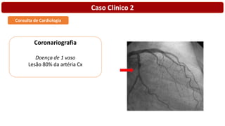 Caso Clínico 2
Consulta de Cardiologia
Coronariografia
Doença de 1 vaso
Lesão 80% da artéria Cx
 