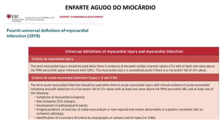 ENFARTE AGUDO DO MIOCÁRDIO
 