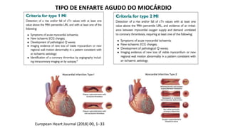 TIPO DE ENFARTE AGUDO DO MIOCÁRDIO
European Heart Journal (2018) 00, 1–33
 