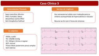 Caso Clínico 3
Sexo masculino, 68 anos
FRCV: fumador, obeso
desconhece outros FRCV
Sem terapêutica habitual
Antecedentes Pessoais
Dor retroesternal súbita com irradiação para os
ombros acompanhada de hipersudorese e náuseas
Recurso ao SU com 2 horas de sintomas
Serviço de Urgência
Pálido, suado
TA= 146/88 mmHg
FC= 58 bpm rítmico e regular
ACP: normal
Pulsos tibiais posteriores pouco amplos
Sem edemas
Ex objetivo
 