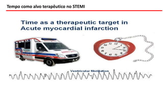 Tempo como alvo terapêutico no STEMI
 