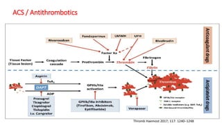 Thromb Haemost 2017; 117: 1240–1248
ACS / Antithrombotics
 