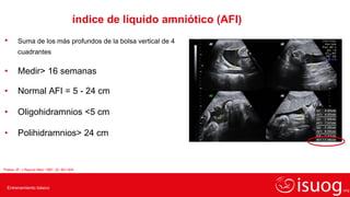 Phelan Normal M4 Placenta y Liquido amniótico ISUOG español.pdf