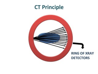 CT Principle RING OF XRAY DETECTORS 
