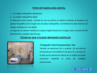 TIPOS DE RADIOLOGÍA DIGITAL
1- La imagen radiográfica digitalizada
2- La imagen radiográfica digital
La diferencia entre ambas consiste en que la primera se obtiene mediante el escaneo o la
captura fotográfica de la imagen de una placa radiográfica, convirtiendo de esta manera una
imagen analógica en una digital.
La segunda se obtiene mediante la captura digital directa de la imagen para convertir los RX
directamente a señales electrónicas.
TÉCNICAS QUE UTILIZAN IMÁGENES DIGITALES
•Tomografía Axial Computarizada ( Tac)
También se denomina Tac o scanner. Es una técnica
introducida por Hounsfield en los años 70 y se basa en
la idea que la estructura interna de un objeto se puede
reconstruir mediante la suma de múltiples
proyecciones.
Índice
 