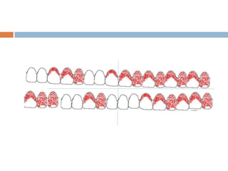 DETERMINACIÓ D’INDICADORS DEL NIVELL DE SALUT BUCODENTAL | PDF