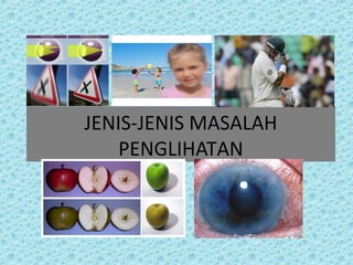 JENIS-JENIS MASALAH 
PENGLIHATAN 
 