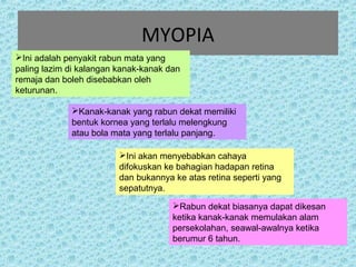 MYOPIA 
Ini adalah penyakit rabun mata yang 
paling lazim di kalangan kanak-kanak dan 
remaja dan boleh disebabkan oleh 
keturunan. 
Kanak-kanak yang rabun dekat memiliki 
bentuk kornea yang terlalu melengkung 
atau bola mata yang terlalu panjang. 
Ini akan menyebabkan cahaya 
difokuskan ke bahagian hadapan retina 
dan bukannya ke atas retina seperti yang 
sepatutnya. 
Rabun dekat biasanya dapat dikesan 
ketika kanak-kanak memulakan alam 
persekolahan, seawal-awalnya ketika 
berumur 6 tahun. 
 
