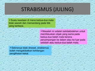STRABISMUS (JULING) 
Suatu keadaan di mana kedua-dua mata 
tidak searah dan memandang pada titik 
yang berbeza. 
Masalah ini adalah ketidakbolehan untuk 
memfokuskan objek yang sama pada 
kedua-dua belah mata kerana 
penyimpangan ke dalam atau ke luar pada 
sebelah atau kedua-dua belah mata. 
Sekiranya tidak dirawat, strabismus 
boleh mengakibatkan kehilangan 
penglihatan kekal. 
 