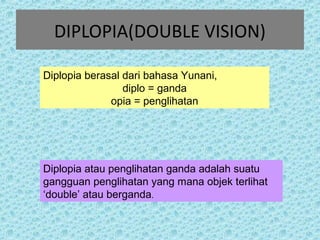 DIPLOPIA(DOUBLE VISION) 
Diplopia berasal dari bahasa Yunani, 
diplo = ganda 
opia = penglihatan 
Diplopia atau penglihatan ganda adalah suatu 
gangguan penglihatan yang mana objek terlihat 
‘double’ atau berganda. 
 