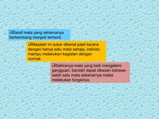 Saraf mata yang seharusnya 
berkembang menjadi terhenti. 
Masalah ini sukar dikenal pasti kerana 
dengan hanya satu mata sahaja, individu 
mampu melakukan kegiatan dengan 
normal. 
Sekiranya mata yang baik mengalami 
gangguan, barulah dapat dikesan bahawa 
salah satu mata sebenarnya malas 
melakukan fungsinya. 
 