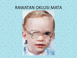 RAWATAN OKLUSI MATA 
 