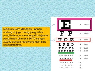 Melalui sistem klasifikasi undang-undang 
ini juga, orang yang kabur 
penglihatannya mempunyai ketajaman 
penglihatan di antara 20/70 dengan 
20/200 dengan mata yang lebih baik 
penglihatannya. 
 