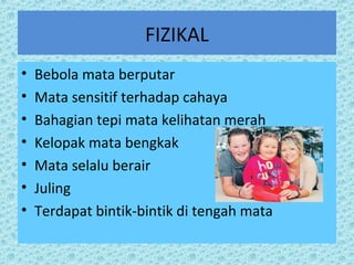 FIZIKAL 
• Bebola mata berputar 
• Mata sensitif terhadap cahaya 
• Bahagian tepi mata kelihatan merah 
• Kelopak mata bengkak 
• Mata selalu berair 
• Juling 
• Terdapat bintik-bintik di tengah mata 
 