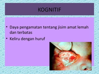KOGNITIF 
• Daya pengamatan tentang jisim amat lemah 
dan terbatas 
• Keliru dengan huruf 
 