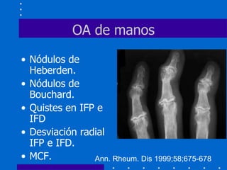 M8 osteoartrosis