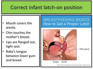 Correct infant latch-on position
• Mouth covers the
areola.
• Chin touches the
mother’s breast.
• Lips are flanged out,
tight seal.
• Baby’s tongue
between lower gum
and breast.
 