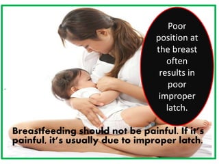 .
Breastfeeding should not be painful. If it’s
painful, it’s usually due to improper latch.
Poor
position at
the breast
often
results in
poor
improper
latch.
 