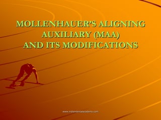 MOLLENHAUER‟S ALIGNING
AUXILIARY (MAA)
AND ITS MODIFICATIONS
www.indiandentalacademy.com
 