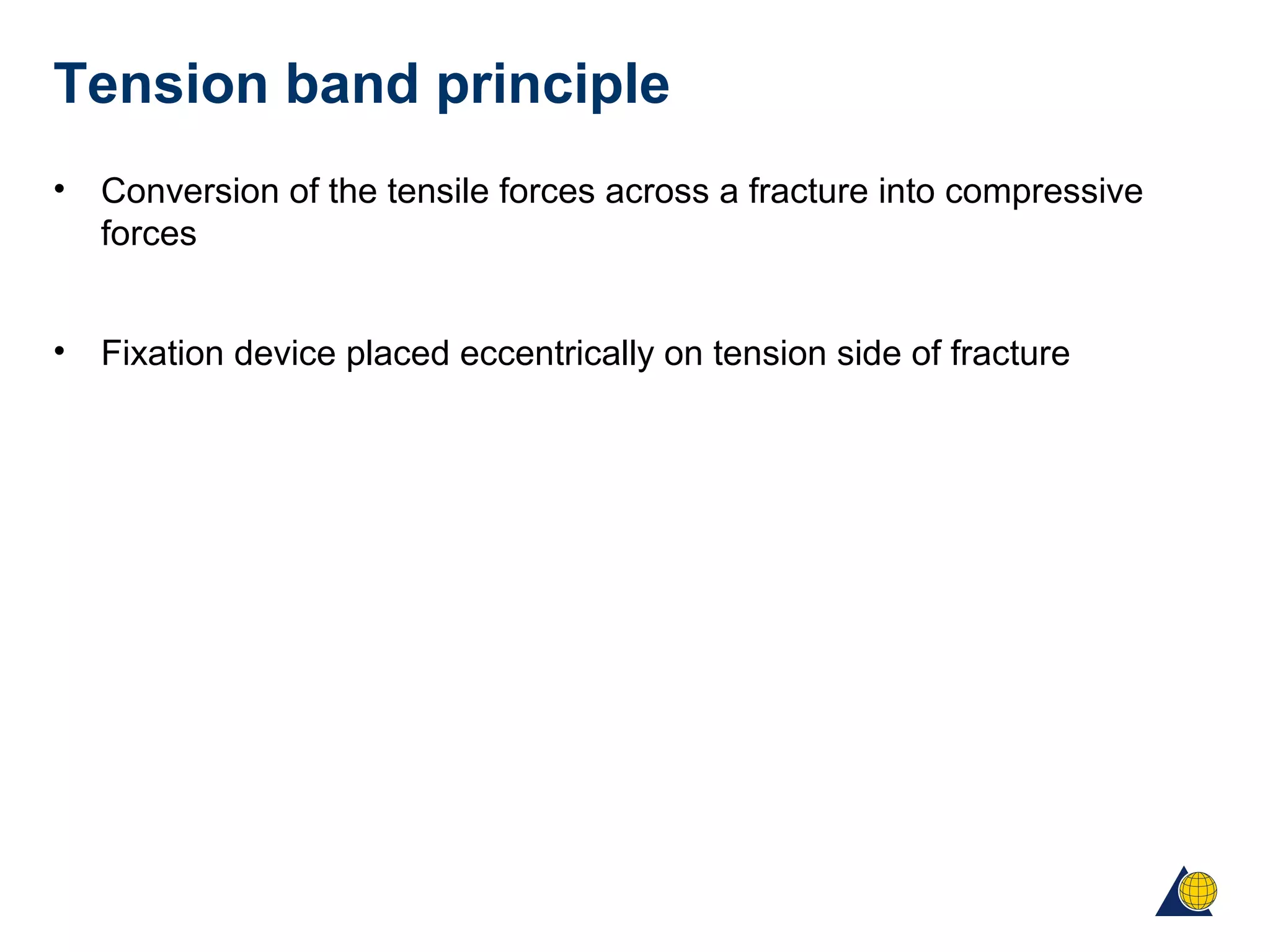 Tension band principle
• Conversion of the tensile forces across a fracture into compressive
forces
• Fixation device placed eccentrically on tension side of fracture
 