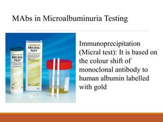 MAbs in Microalbuminuria Testing
Immunoprecipitation
(Micral test): It is based on
the colour shift of
monoclonal antibody to
human albumin labelled
with gold
 