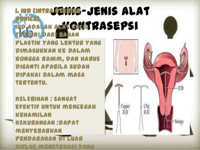  ALAT  ALAT  KONTRASEPSI 