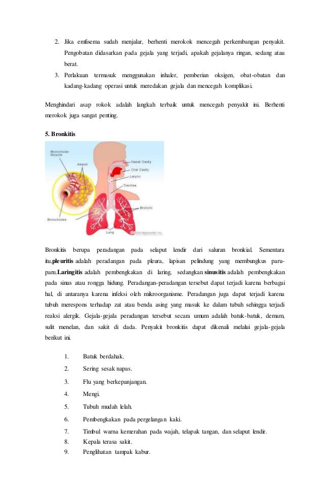 Macam macam jenis penyakit pada sistem pernapasan