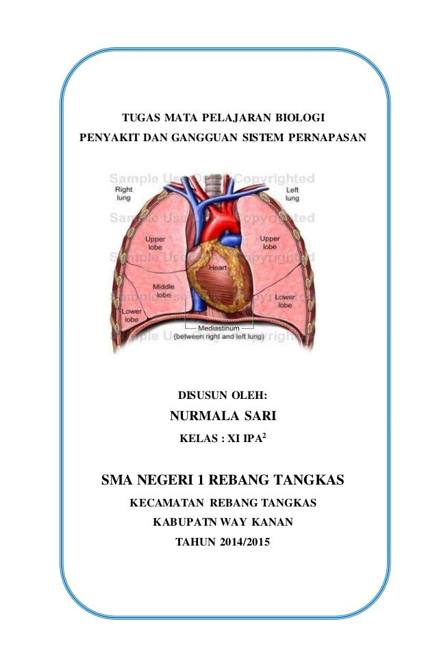 Macam Macam Jenis Penyakit Pada Sistem Pernapasan 2 Macam Macam Jenis Penyakit Pada Sistem Pernapasan 2