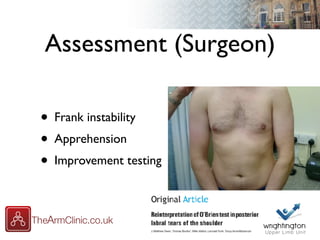Assessment (Surgeon)
• Frank instability
• Apprehension
• Improvement testing
 