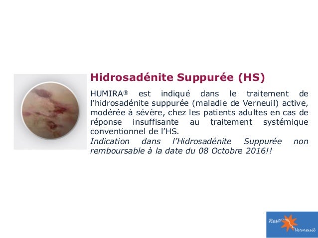 Maladie de Verneuil (hidradénite suppurée): rationnel Maladie de Verneuil (hidradénite suppurée): rationnel