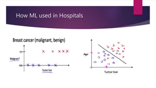 How ML used in Hospitals
 