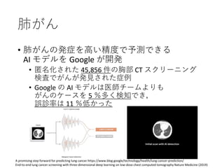 肺がん
A promising step forward for predicting lung cancer https://www.blog.google/technology/health/lung-cancer-prediction/
End-to-end lung cancer screening with three-dimensional deep learning on low-dose chest computed tomography Nature Medicine (2019)
• 肺がんの発症を高い精度で予測できる
AI モデルを Google が開発
• 匿名化された 45,856 件の胸部 CT スクリーニング
検査でがんが発見された症例
• Google の AI モデルは医師チームよりも
がんのケースを 5 ％多く検知でき，
誤診率は 11 ％低かった
 